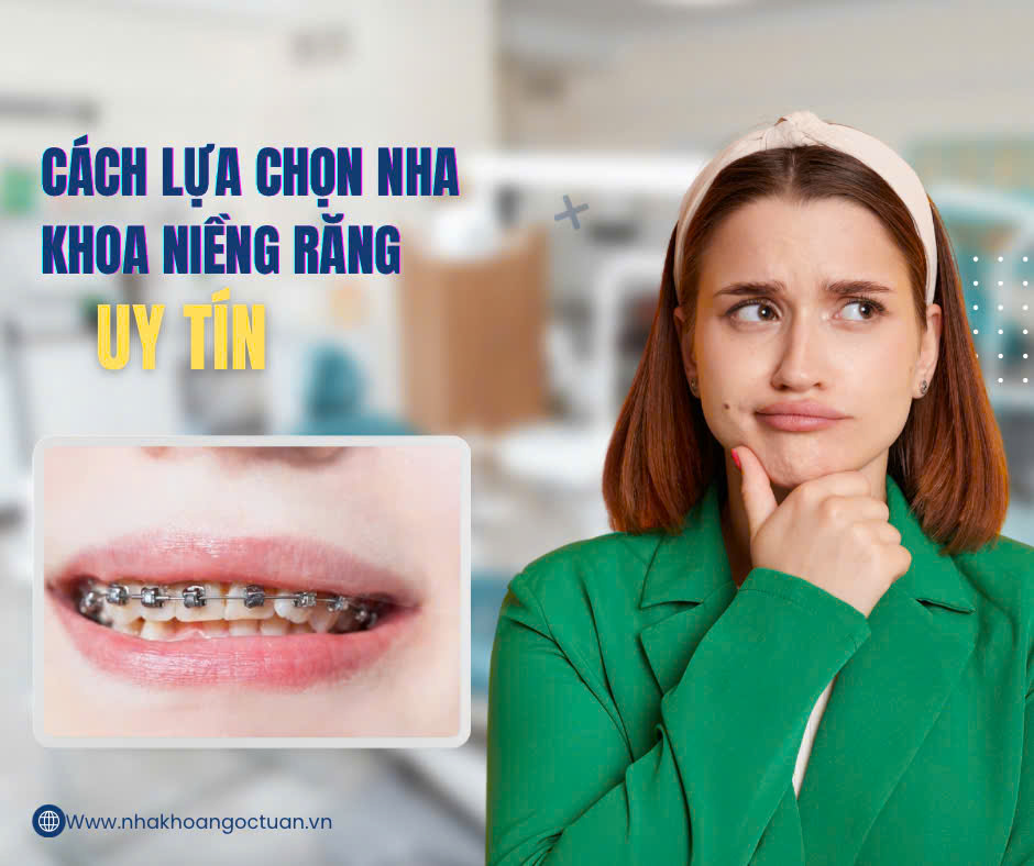 cách lựa chọn nha khoa uy tín để niềng răng