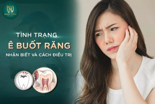 Răng Ê Buốt Là Gì? Cách Giảm Ê Buốt Nhanh Và Ngăn Ngừa Tái Phát