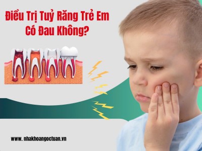 Điều Trị Tủy Cho Trẻ em Có Đau Không?