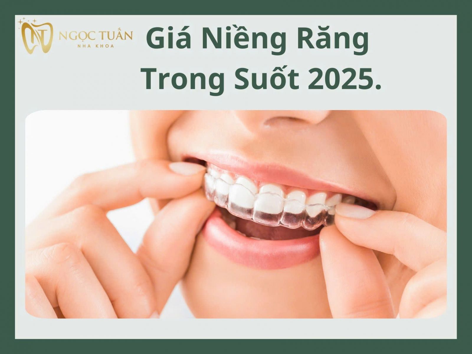 giá niềng răng khay trong suốt