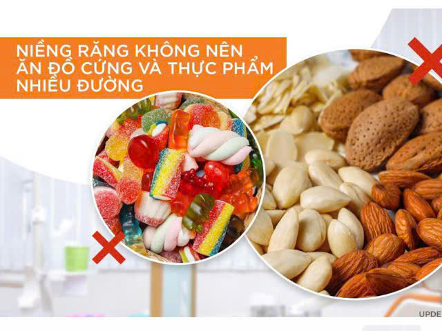 mới niềng răng kiêng ăn gì?