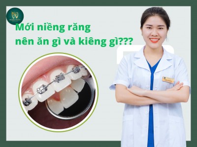 Mới Niềng Răng Nên Ăn Gì Và Kiêng Gì? 