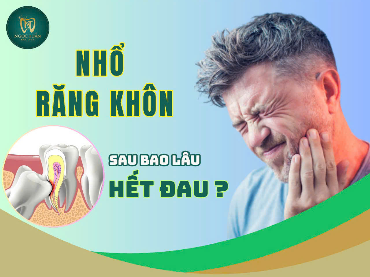 nhổ răng khôn bao nhiêu ngày thì hết đau