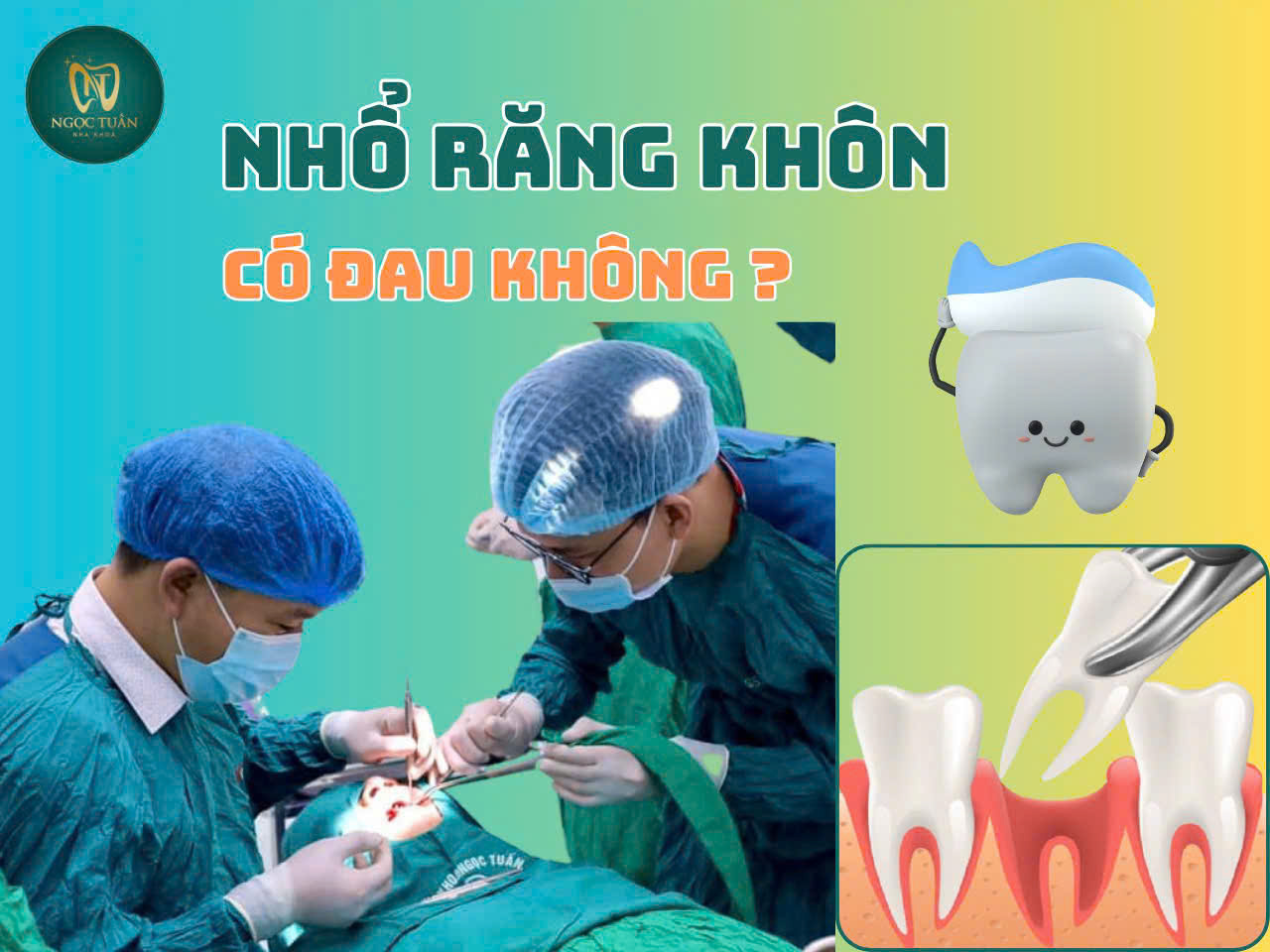 nhổ răng khôn có đau không?