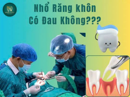 Nhổ Răng Khôn Có Đau Không? Những Điều Bạn Cần Biết