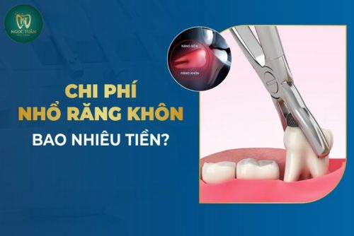 Nhổ Răng Khôn Bao Nhiêu Tiền? Bảng Giá Mới Nhất & Địa Chỉ Uy Tín Tại Thái Bình