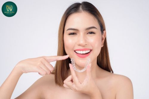  Chỉnh Nha Trong Suốt Invisalign: Có Hiệu Quả Như Mắc Cài Không?