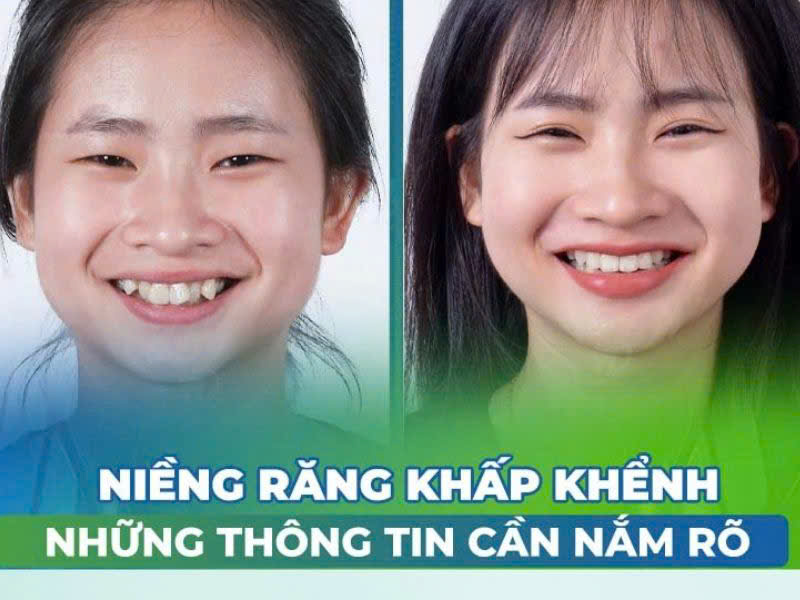 nhung-luu-y-khi-nieng-rang-khap-khenh