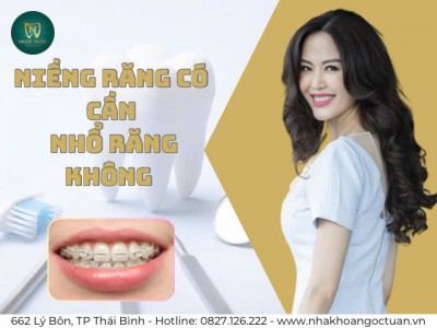 Niềng Răng Có Cần Nhổ Răng Không?