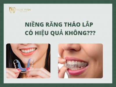 Niêng Răng Tháo Lắp Có Hiệu quả Không?