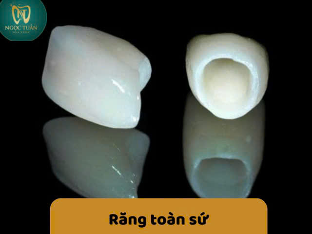 răng toàn sứ