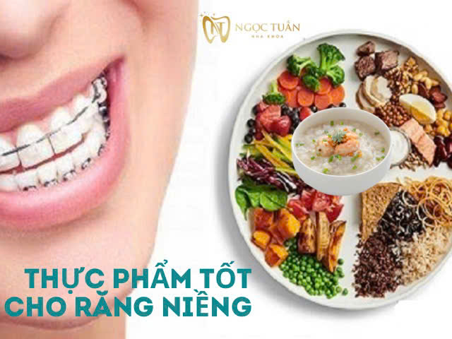 mới niềng răng nên ăn gì?