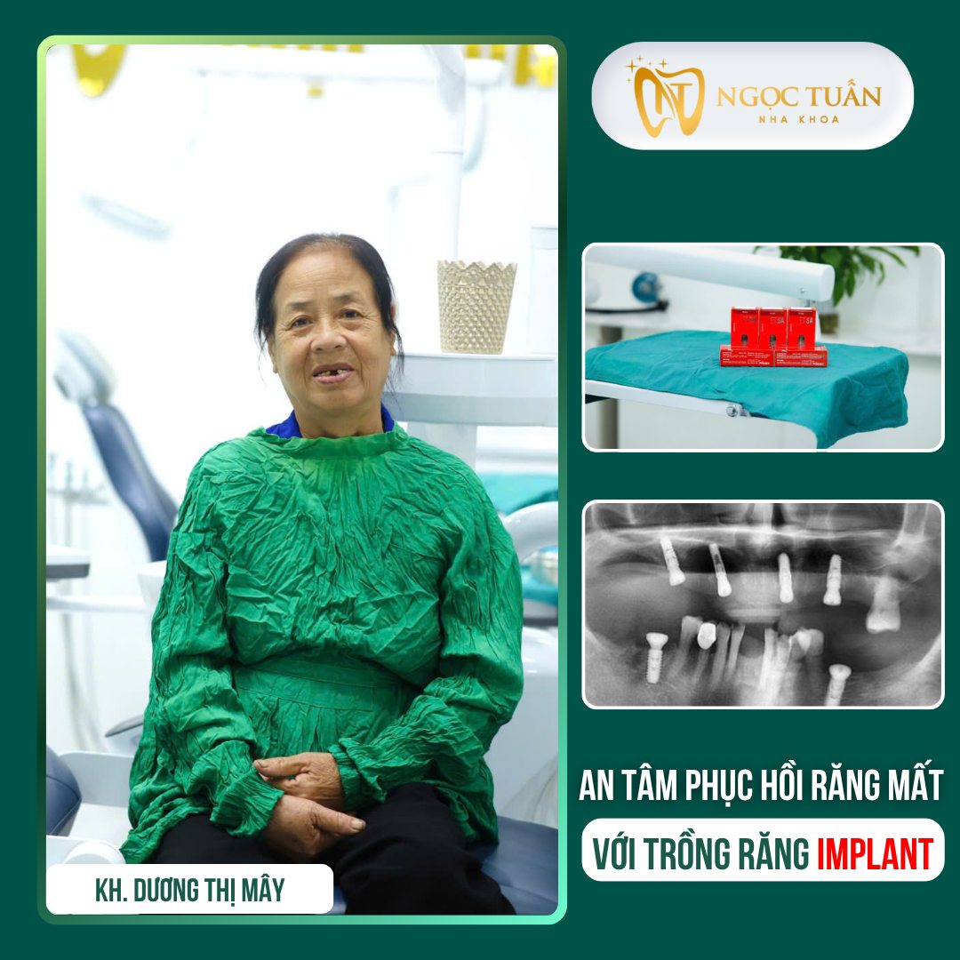 feedback khach hang trong rang tai nha khoa ngoc tuan (3)