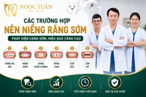 Các trường hợp nên niềng răng sớm như răng hô, móm, chen chúc, răng thưa, cắn sâu và cắn hở giúp đạt hiệu quả chỉnh nha tối ưu tại Nha khoa Ngọc Tuấn Thái Bình.