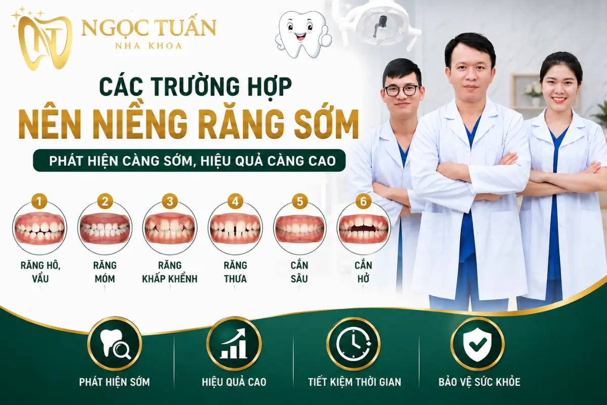 Các trường hợp nên niềng răng sớm như răng hô, móm, chen chúc, răng thưa, cắn sâu và cắn hở giúp đạt hiệu quả chỉnh nha tối ưu tại Nha khoa Ngọc Tuấn Thái Bình.