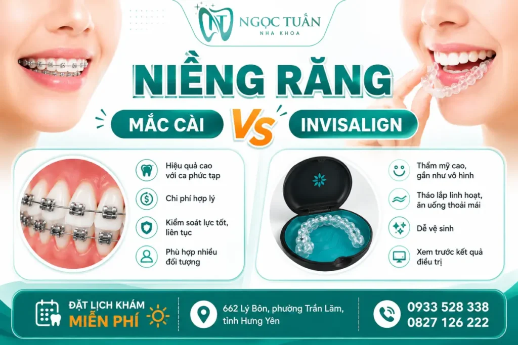 Niềng răng mắc cài hay Invisalign tại Nha khoa Ngọc Tuấn Thái Bình