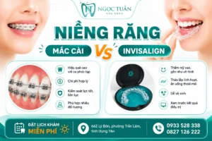 Niềng răng mắc cài hay Invisalign tại Nha khoa Ngọc Tuấn Thái Bình