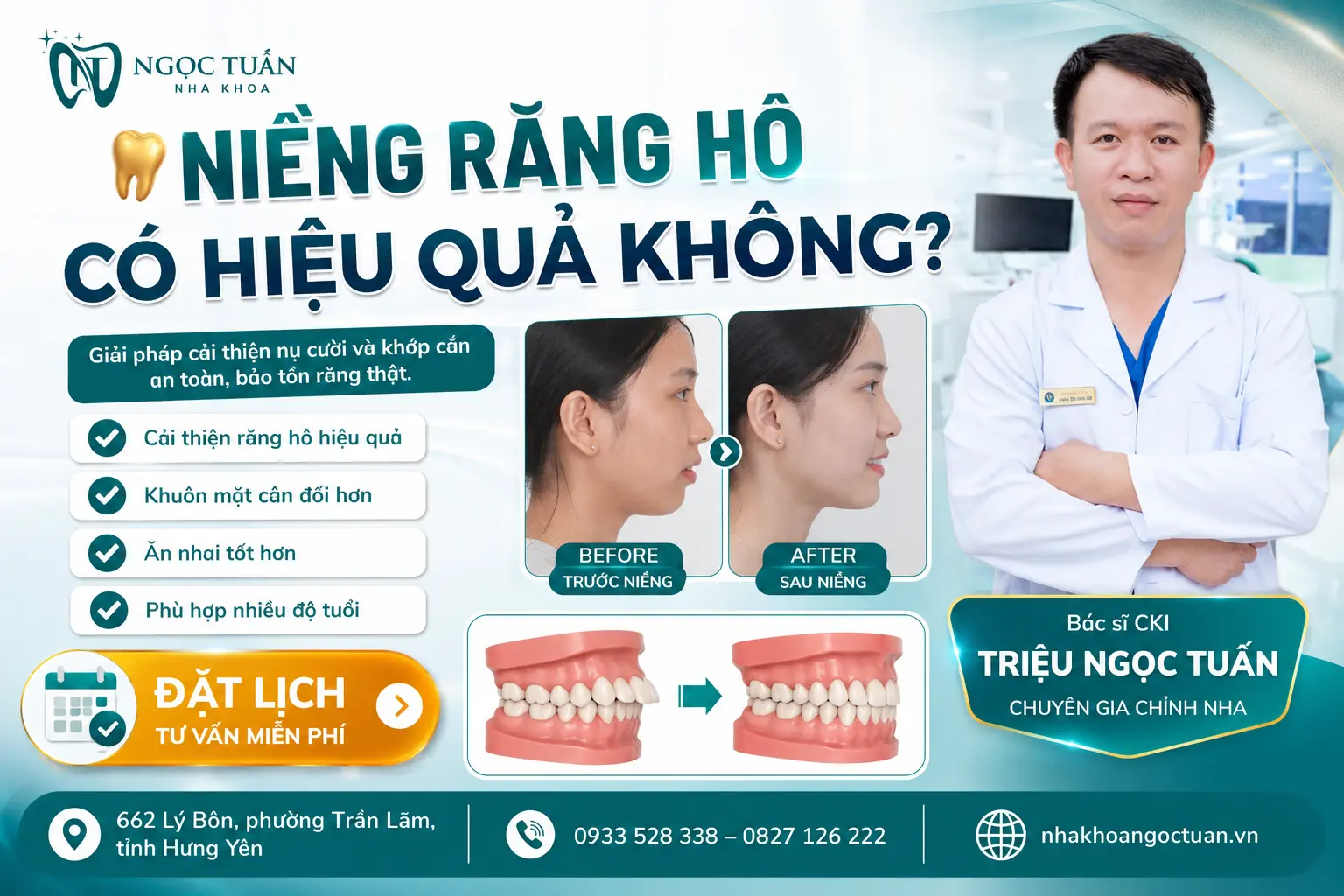 Niềng răng hô tại Nha khoa Ngọc Tuấn giúp cải thiện khớp cắn, cân đối khuôn mặt và mang lại nụ cười tự tin với bác sĩ CKI Triệu Ngọc Tuấn.