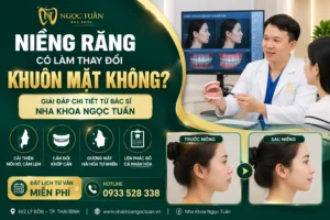 Niềng răng có làm thay đổi khuôn mặt không? Bác sĩ CKI Triệu Ngọc Tuấn tư vấn chỉnh nha giúp cải thiện khớp cắn, cân đối gương mặt và nụ cười tự tin tại Thái Bình.