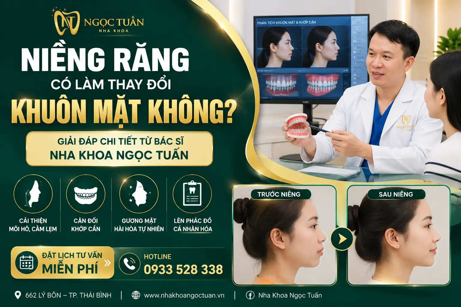 Niềng răng có làm thay đổi khuôn mặt không? Bác sĩ CKI Triệu Ngọc Tuấn tư vấn chỉnh nha giúp cải thiện khớp cắn, cân đối gương mặt và nụ cười tự tin tại Thái Bình.