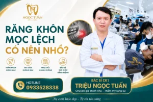 Banner răng khôn mọc lệch có nên nhổ? Bác sĩ Nha khoa Ngọc Tuấn tư vấn thời điểm nhổ an toàn, hạn chế biến chứng.