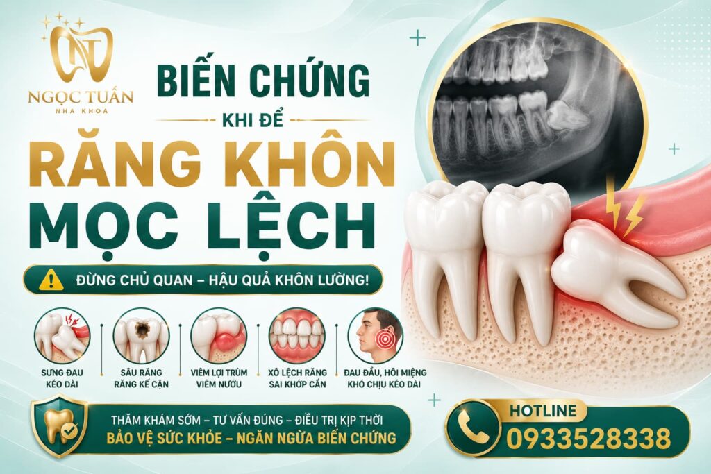 Banner cảnh báo biến chứng khi để răng khôn mọc lệch như viêm lợi, sâu răng số 7, tiêu xương và lệch khớp cắn.