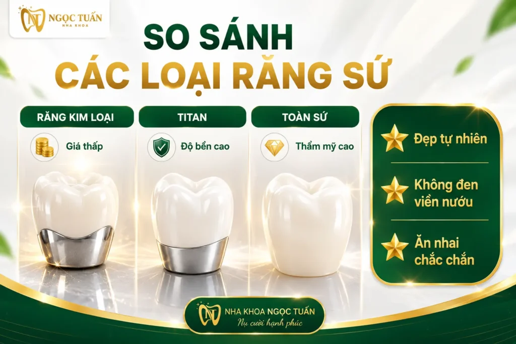 So sánh răng sứ kim loại, Titan và toàn sứ về thẩm mỹ, độ bền và chi phí để lựa chọn phù hợp.