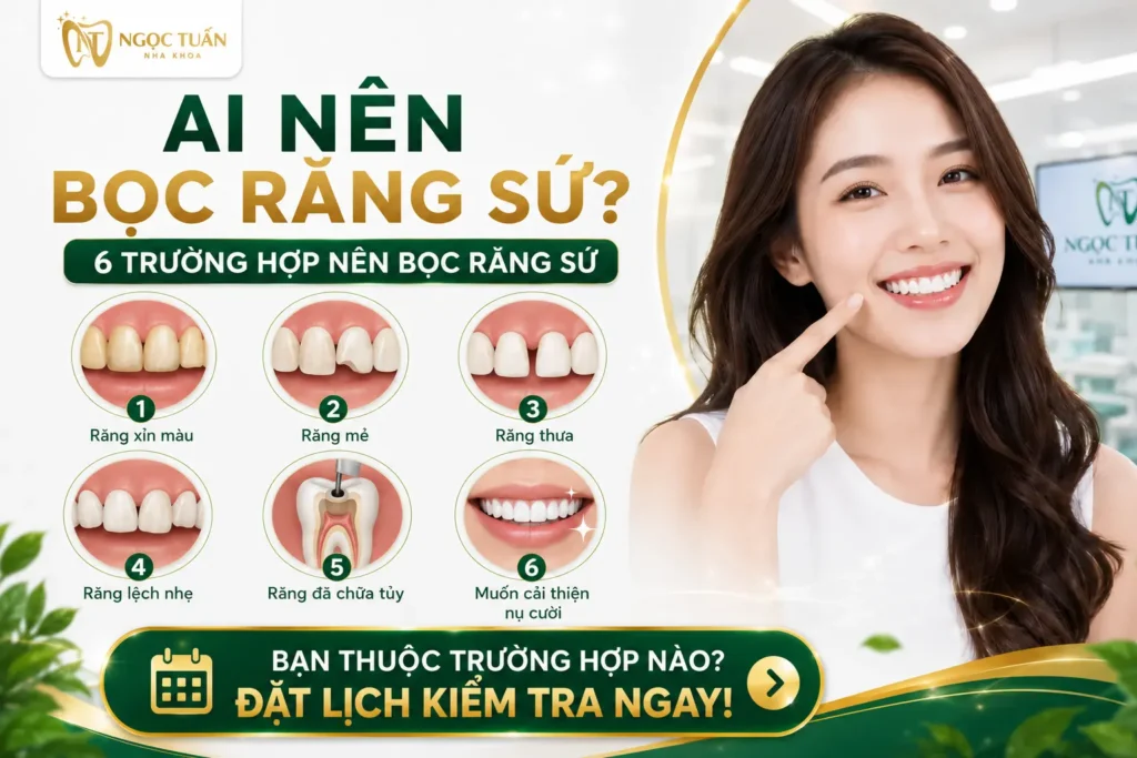 Những trường hợp nên bọc răng sứ như răng xỉn màu, răng mẻ, răng thưa, răng lệch nhẹ hoặc răng đã điều trị tủy.