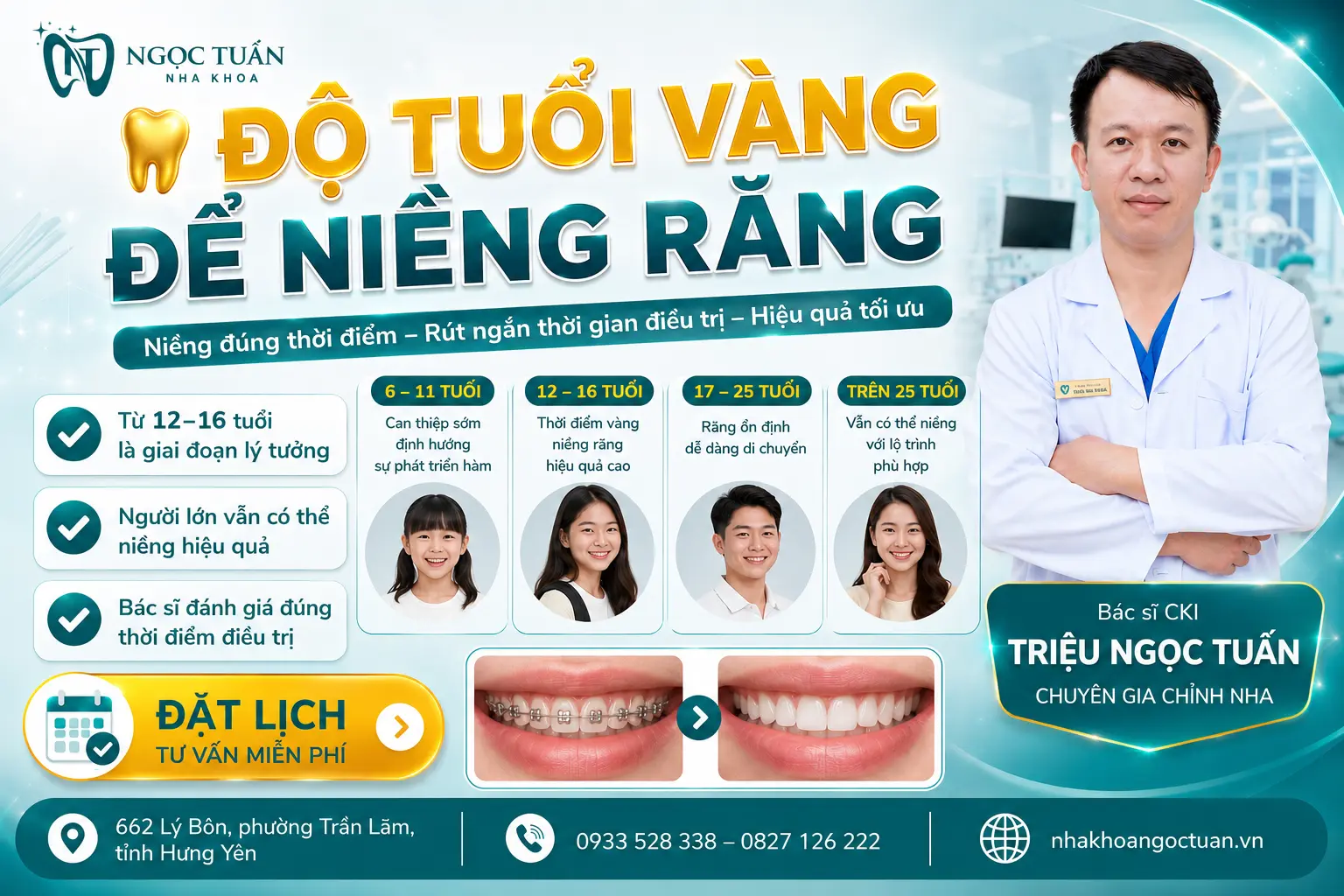 Độ tuổi vàng để niềng răng từ 12 đến 16 tuổi giúp răng dịch chuyển thuận lợi, rút ngắn thời gian điều trị tại Nha khoa Ngọc Tuấn.