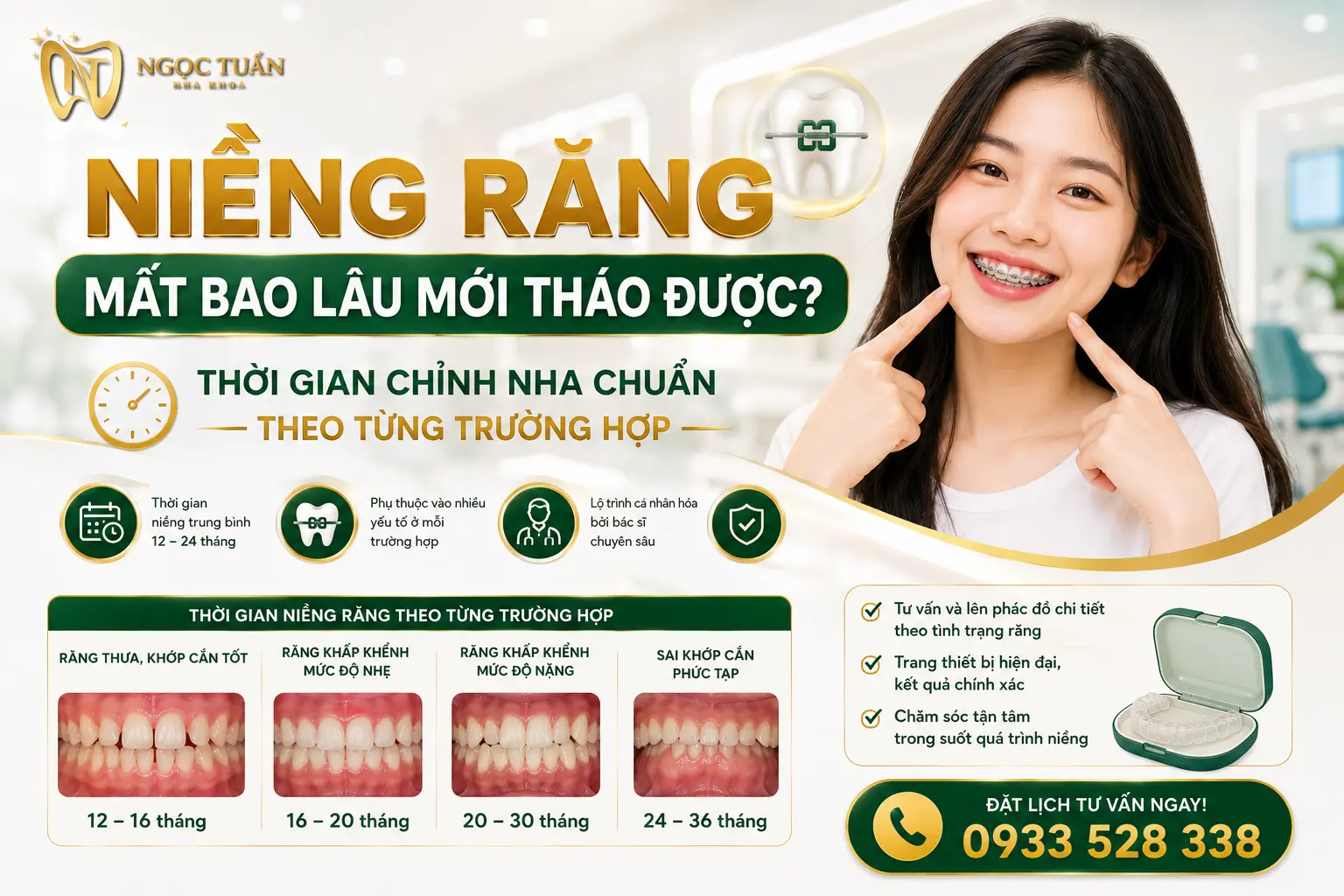 Niềng răng mất bao lâu mới tháo được? Thời gian chỉnh nha chuẩn theo từng trường hợp tại Nha khoa Ngọc Tuấn Thái Bình