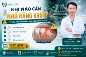Khi nào cần nhổ răng khôn? 7 dấu hiệu cảnh báo cần nhổ răng khôn sớm để tránh biến chứng tại Nha khoa Ngọc Tuấn.