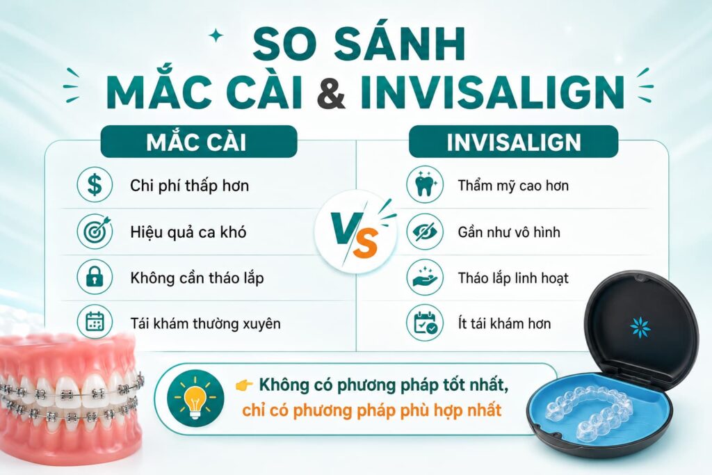 So sánh niềng răng mắc cài và Invisalign chi tiết