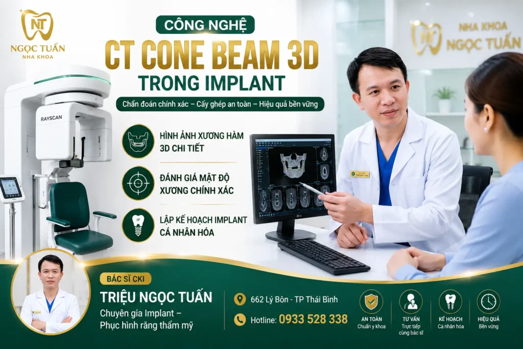 Công nghệ CT Cone Beam 3D trong Implanthỗ trợ chẩn đoán và lập kế hoạch cấy ghép Implant chính xác