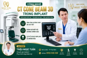Công nghệ CT Cone Beam 3D trong Implanthỗ trợ chẩn đoán và lập kế hoạch cấy ghép Implant chính xác