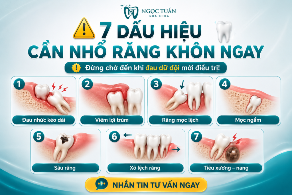 7 dấu hiệu cần nhổ răng khôn gồm đau nhức, viêm lợi trùm, mọc lệch, mọc ngầm, sâu răng, xô lệch răng và tiêu xương.