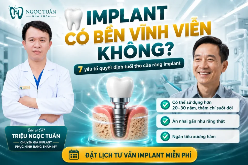 Hình ảnh bác sĩ tư vấn về tuổi thọ răng Implant. Giải đáp Implant có bền vĩnh viễn không, các yếu tố quyết định độ bền và lợi ích của cấy ghép Implant tại Nha khoa Ngọc Tuấn.