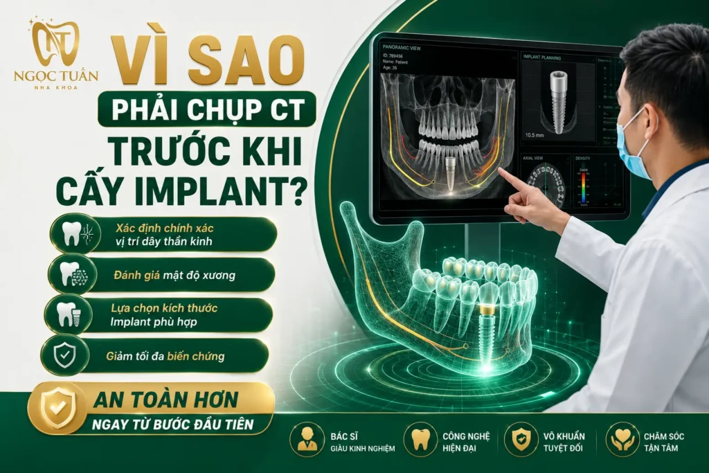CT Cone Beam 3D giúp xác định chất lượng xương hàm, vị trí dây thần kinh và lựa chọn kích thước Implant phù hợp, giảm thiểu rủi ro điều trị.