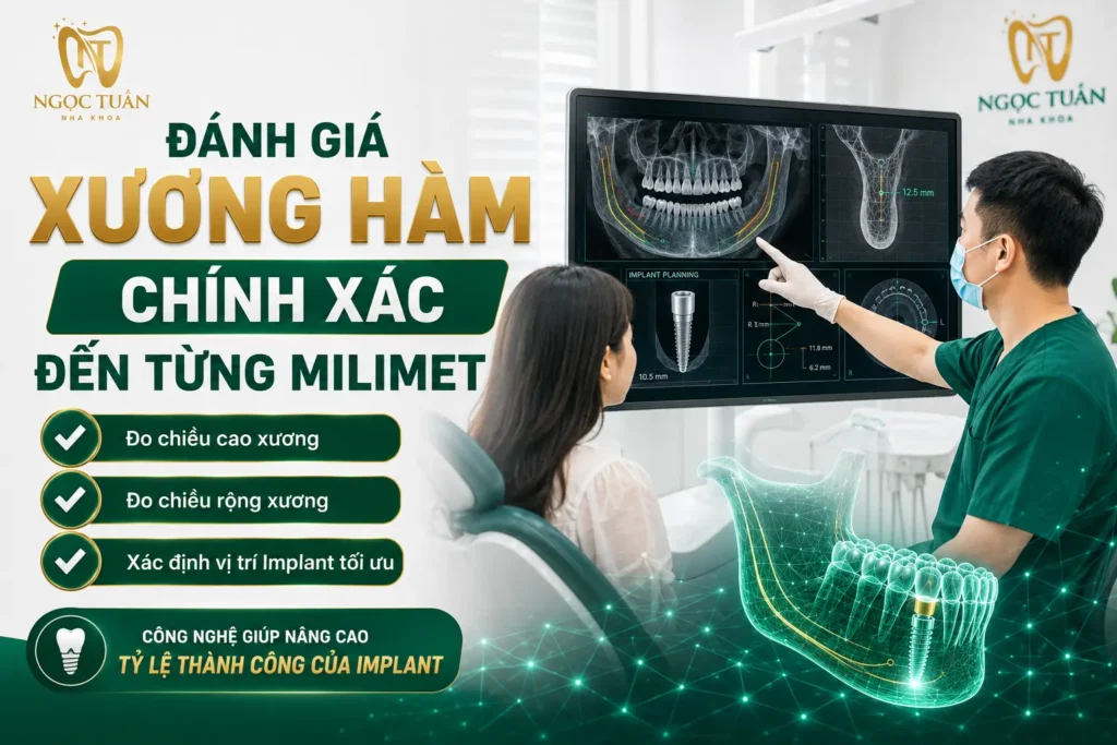 Hình ảnh CT Cone Beam 3D cung cấp dữ liệu chi tiết về mật độ và thể tích xương, giúp nâng cao độ chính xác khi cấy ghép Implant.