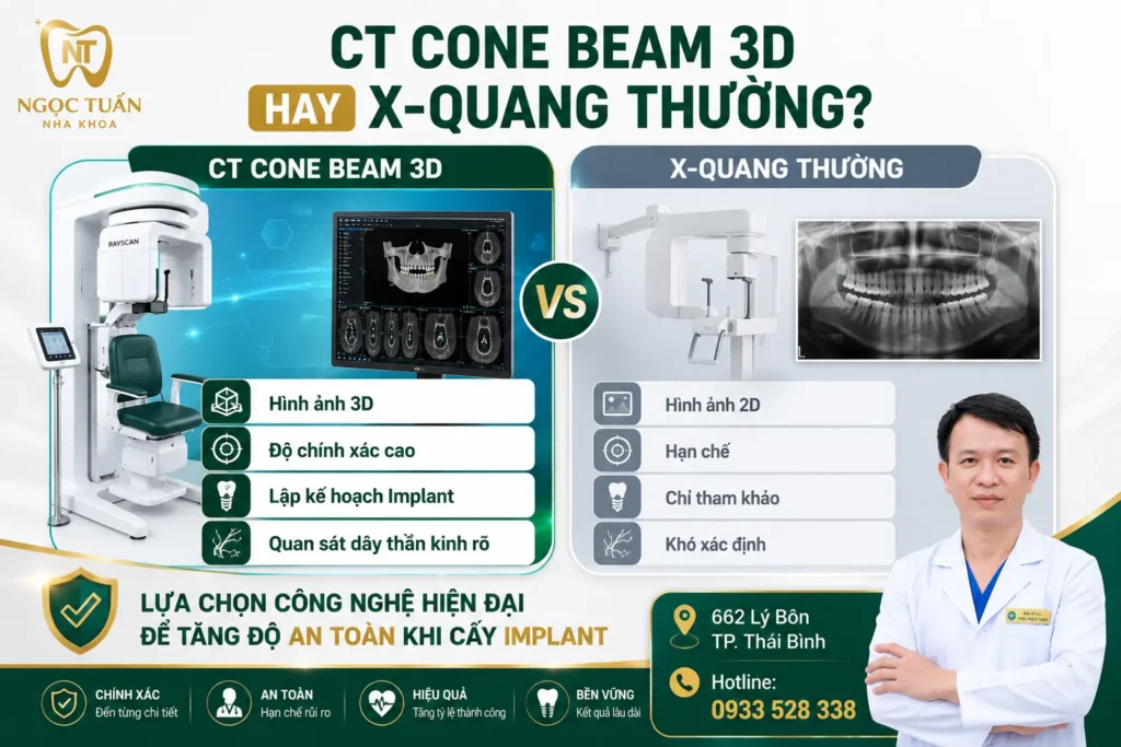 CT Cone Beam 3D cung cấp hình ảnh ba chiều chi tiết hơn X-quang 2D, giúp đánh giá chính xác cấu trúc xương hàm và tăng độ an toàn khi cấy Implant.