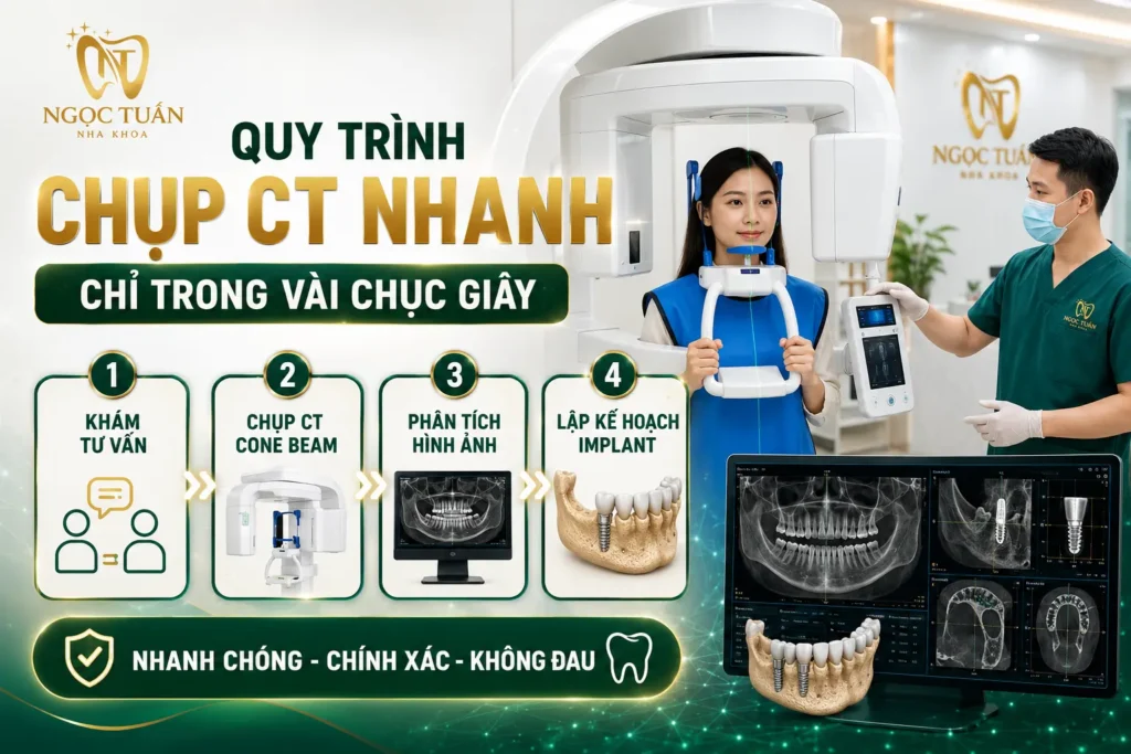 Chụp CT Cone Beam là bước kiểm tra quan trọng trước khi trồng Implant, giúp bác sĩ thu thập dữ liệu chính xác để lên kế hoạch điều trị.