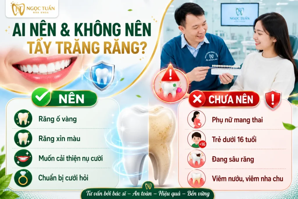 Những trường hợp nên và không nên tẩy trắng răng theo khuyến cáo của bác sĩ nha khoa.