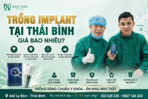 Trồng Implant tại Thái Bình giá bao nhiêu? Cập nhật bảng giá cấy ghép Implant mới nhất 2026, tư vấn lựa chọn trụ Implant chính hãng, bác sĩ giàu kinh nghiệm, chi phí minh bạch.