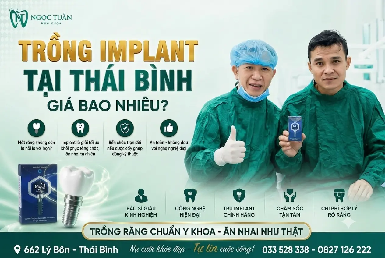 Trồng Implant tại Thái Bình giá bao nhiêu? Cập nhật bảng giá cấy ghép Implant mới nhất 2026, tư vấn lựa chọn trụ Implant chính hãng, bác sĩ giàu kinh nghiệm, chi phí minh bạch.