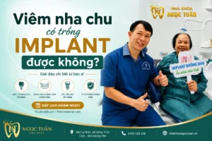 Viêm nha chu có trồng Implant được không? Giải đáp từ bác sĩ Nha khoa Ngọc Tuấn, điều trị nha chu ổn định trước khi cấy ghép Implant an toàn, tỷ lệ thành công cao.
