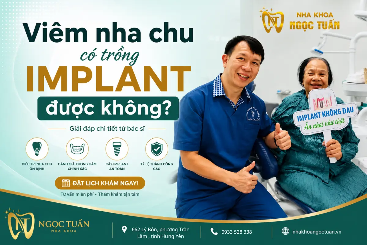 Viêm nha chu có trồng Implant được không? Giải đáp từ bác sĩ Nha khoa Ngọc Tuấn, điều trị nha chu ổn định trước khi cấy ghép Implant an toàn, tỷ lệ thành công cao.