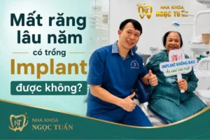 Mất răng lâu năm có trồng Implant được không - Nha khoa Ngọc Tuấn