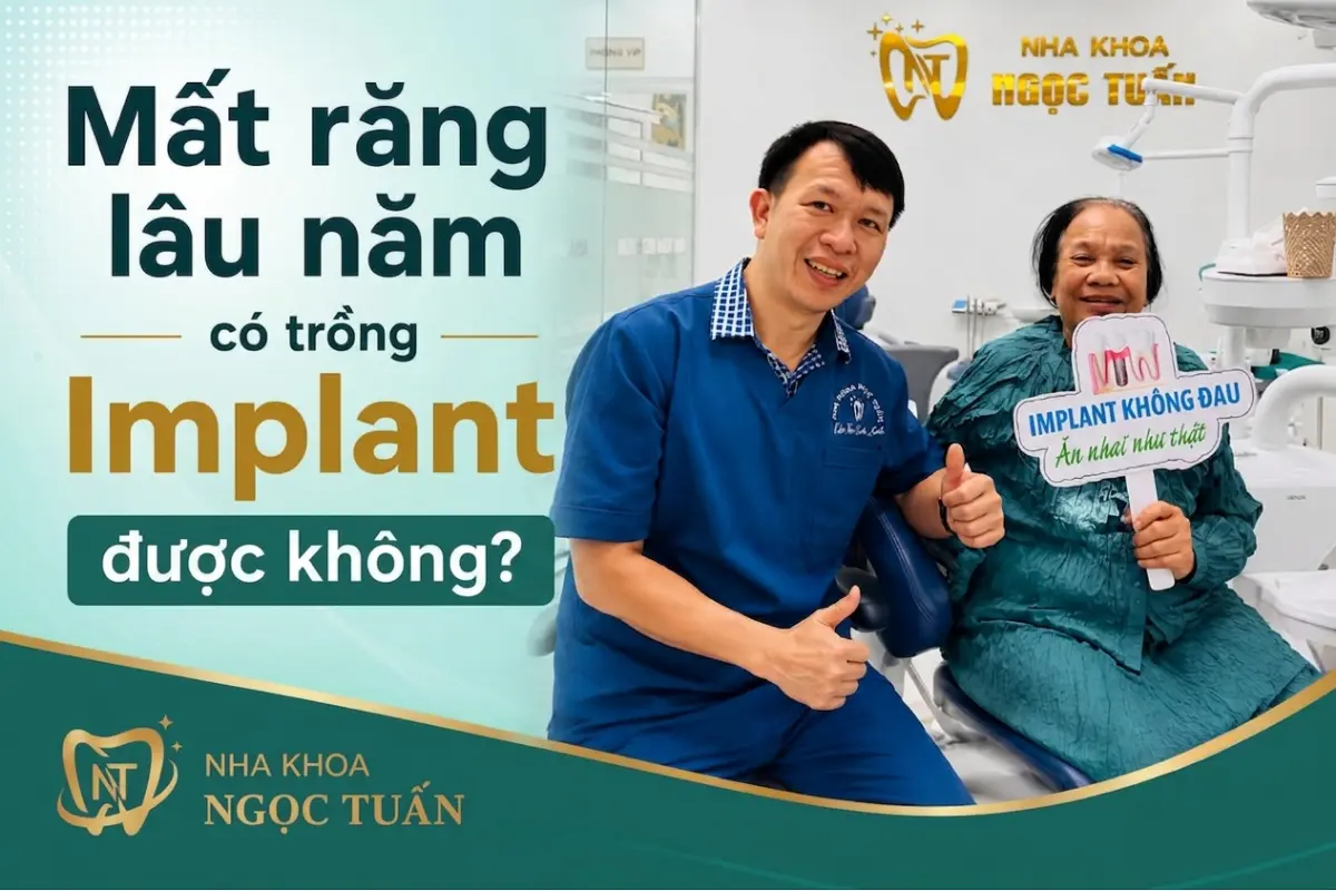Mất răng lâu năm có trồng Implant được không - Nha khoa Ngọc Tuấn
