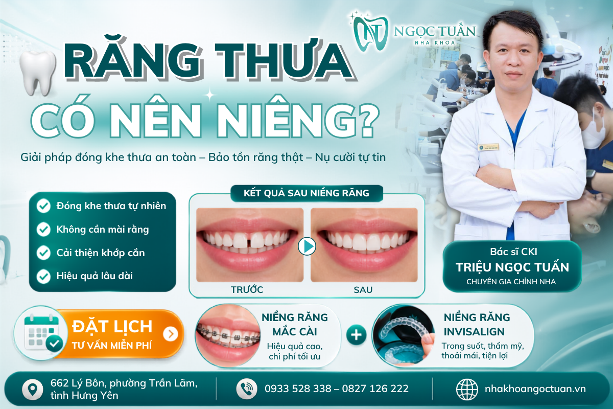 Răng thưa có nên niềng không? Hình ảnh bác sĩ tư vấn niềng răng thưa tại Nha khoa Ngọc Tuấn giúp đóng khe thưa, bảo tồn răng thật.