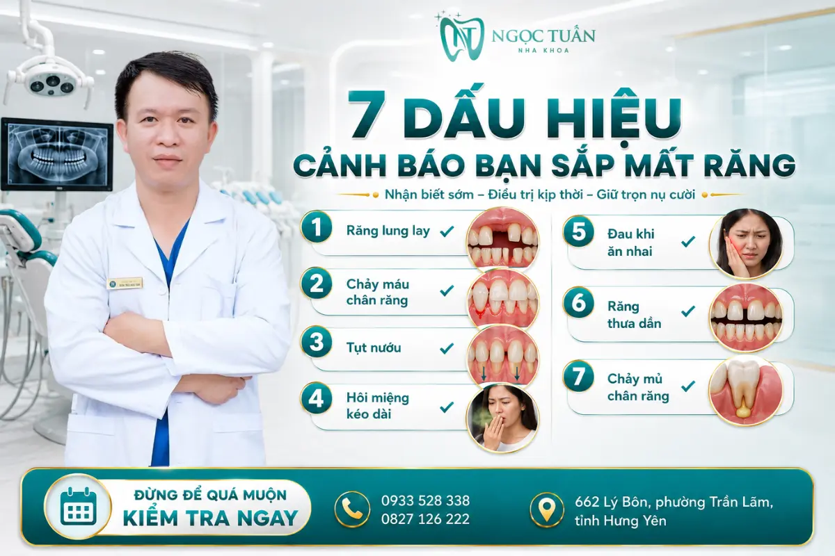7 dấu hiệu cảnh báo bạn sắp mất răng
