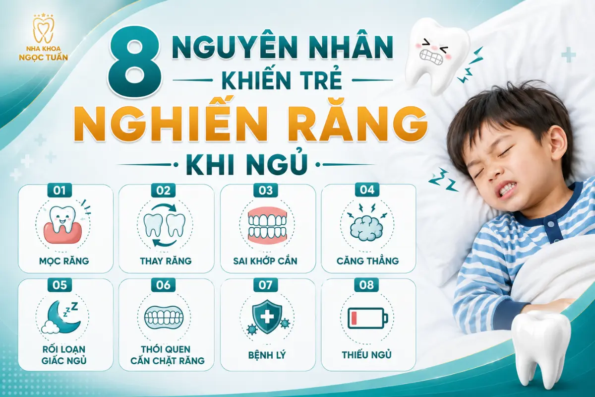 Vì sao trẻ hay nghiến răng khi ngủ? Trẻ có thể nghiến răng do mọc răng, thay răng, sai khớp cắn, căng thẳng hoặc rối loạn giấc ngủ. Tìm hiểu nguyên nhân để có hướng chăm sóc phù hợp.